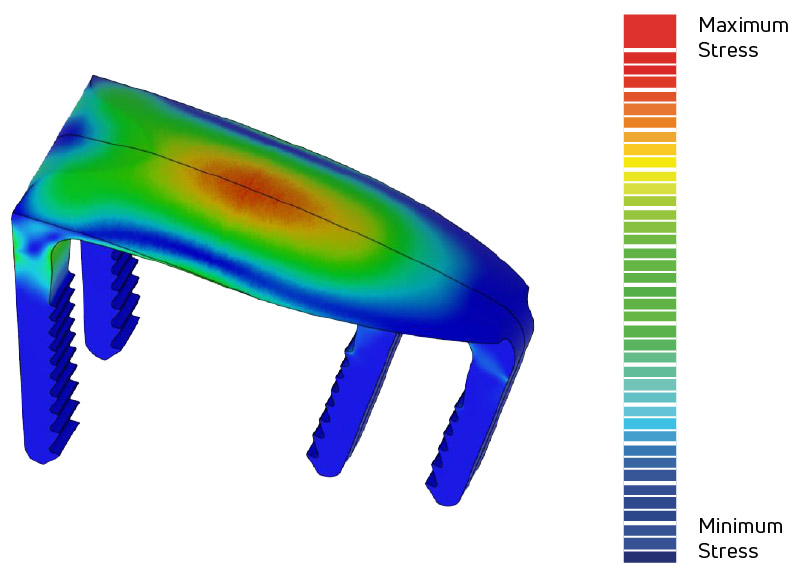 Analysis of Bending Stresses
