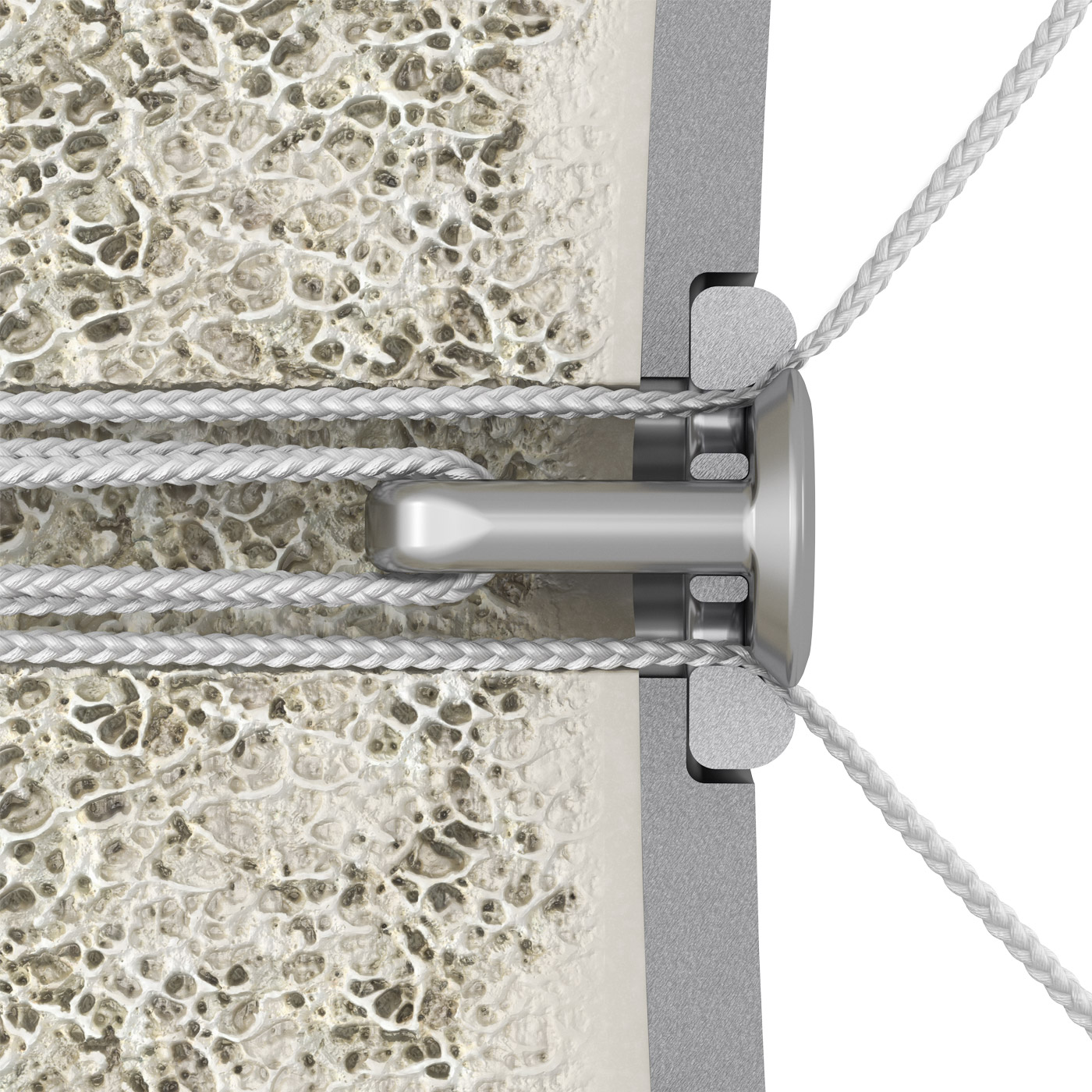 Enofix detail