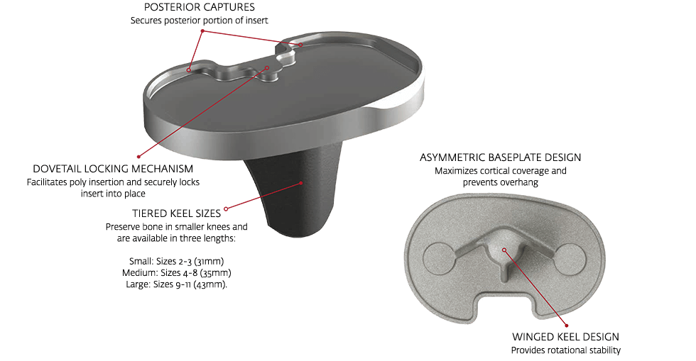 TIBIAL BASEPLATE