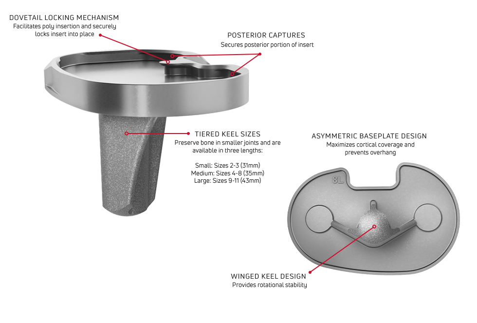 TIBIAL BASEPLATE