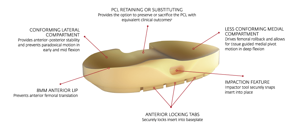 TIBIAL INSERT
