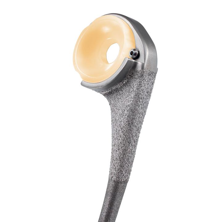 Ulnar Stem